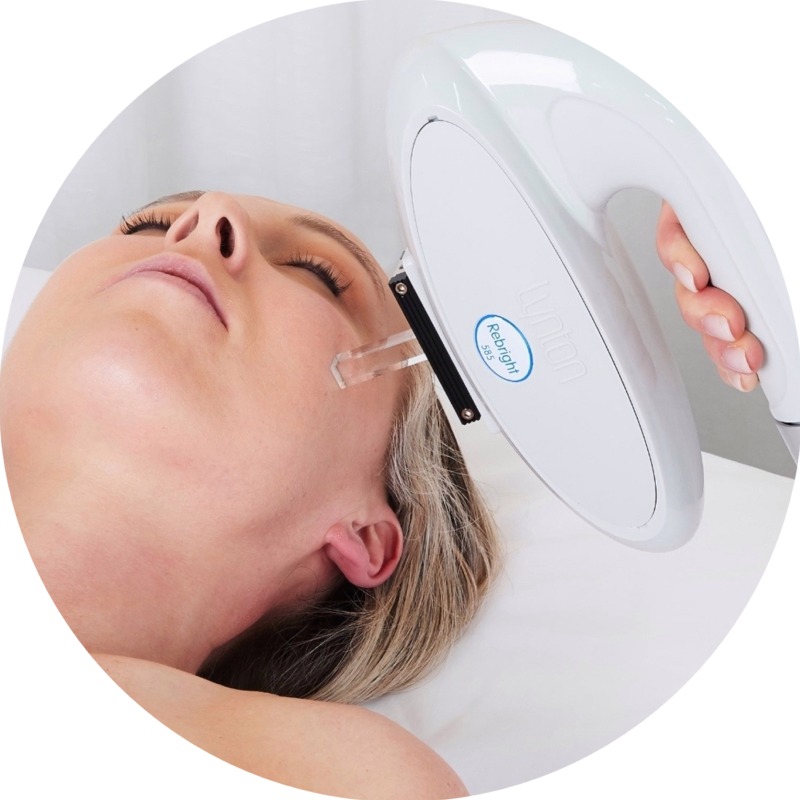 IPL Hair Removal Hednesford